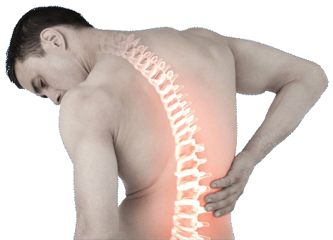 Fiona Medical Back Pain Image