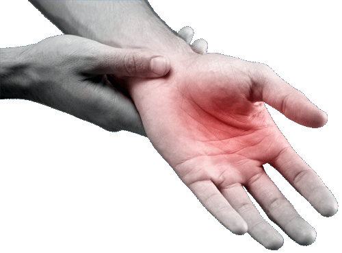 Peripheral Neuropathy Image